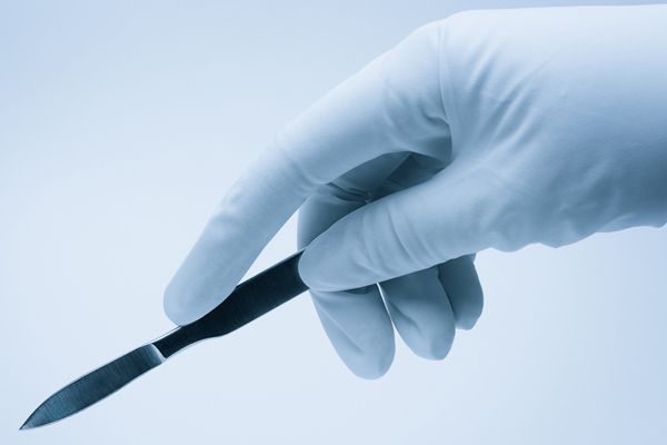 Gloved hand holding a scalpel